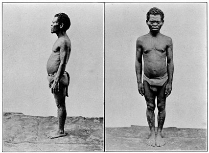 Negrito man of Zambales.